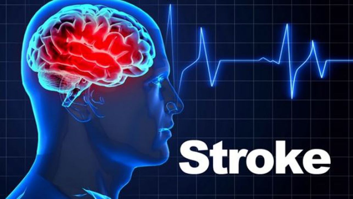 Breakthrough in Stroke Care